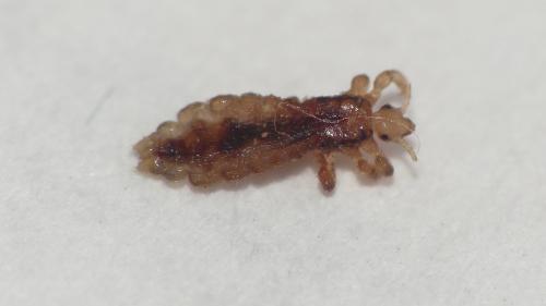 Pediculus capitis
